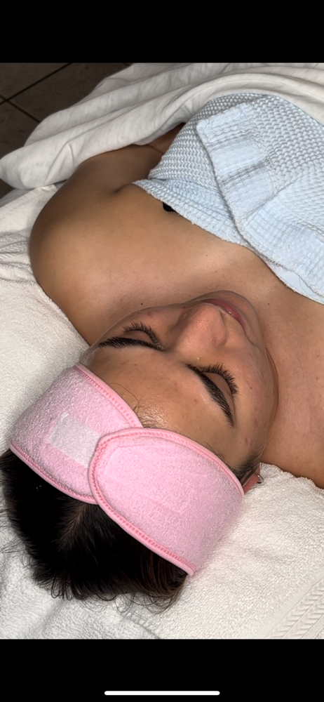 Chemical Peel