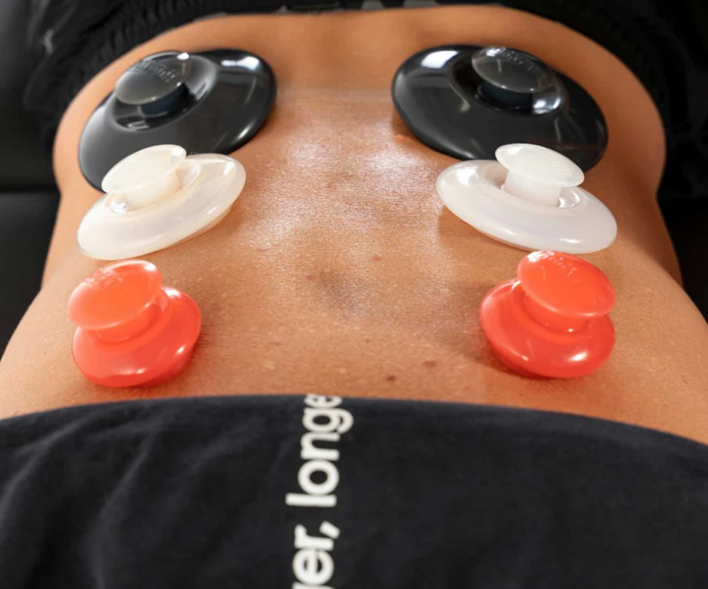 Cupping Therapy Add On