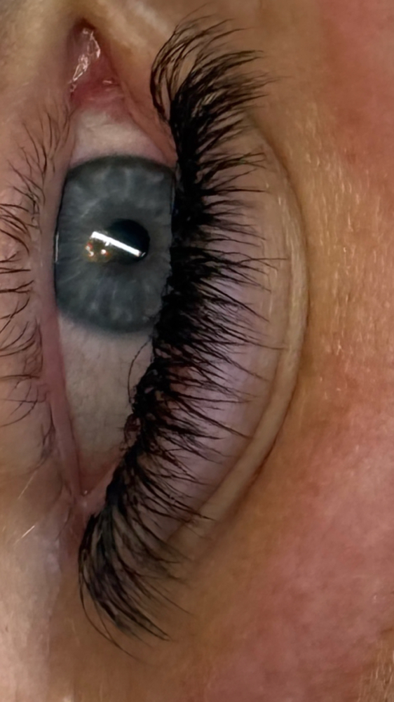 3 Week Extended Or Foreign Fill