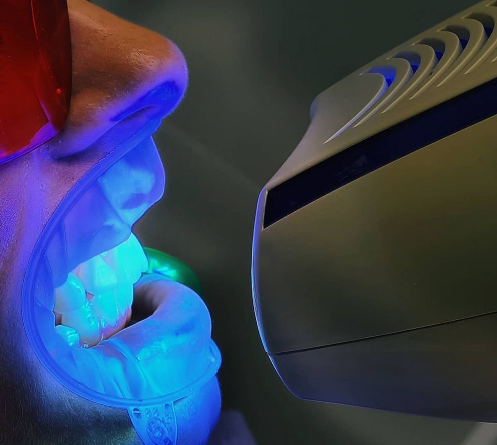 Teeth Whitening 60 Mins at Avenue Salon & Spa in Hoquiam, WA