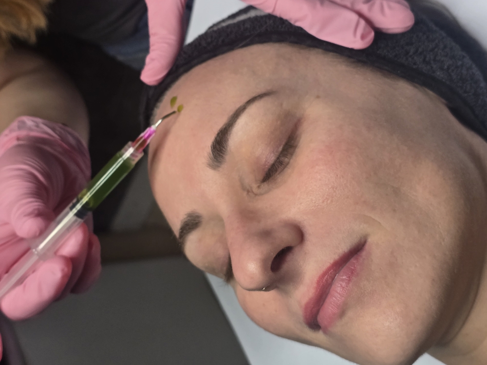 BioRePeel - Chemical Peel