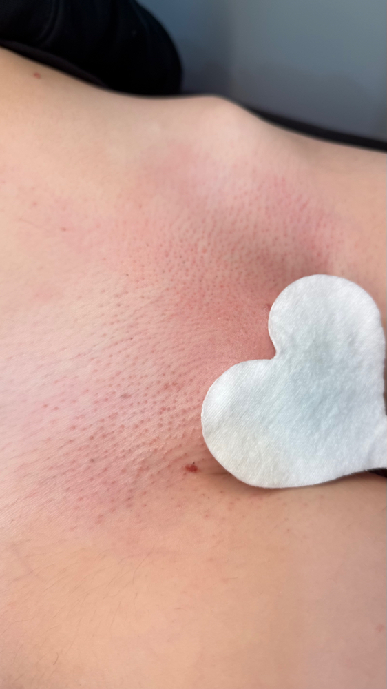 NEW CLIENT FULL BRAZILIAN WAX