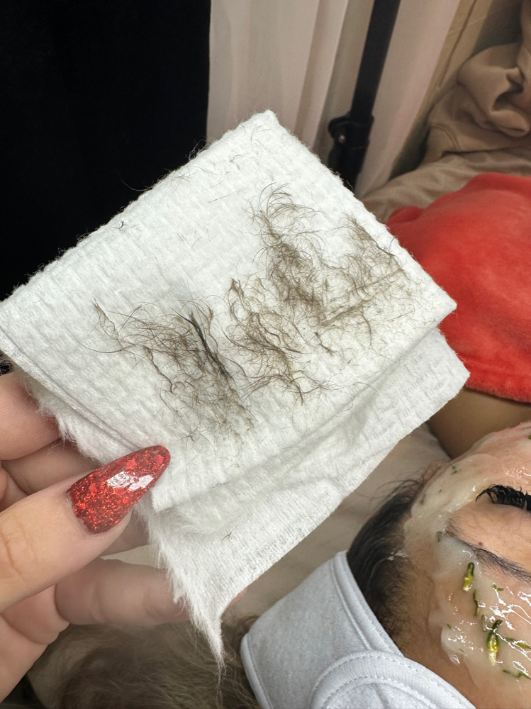 Dermaplane Facial