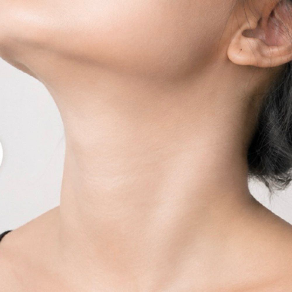 Whitening (Neck) at Yadis Nails & Spa Laser in Austin, TX