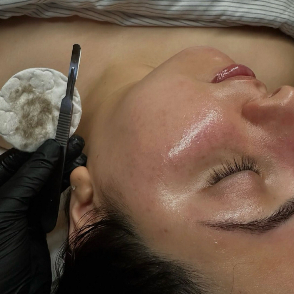 Dermaplaning Add-On at Lumière Maison Esthetics in Bethany, OK