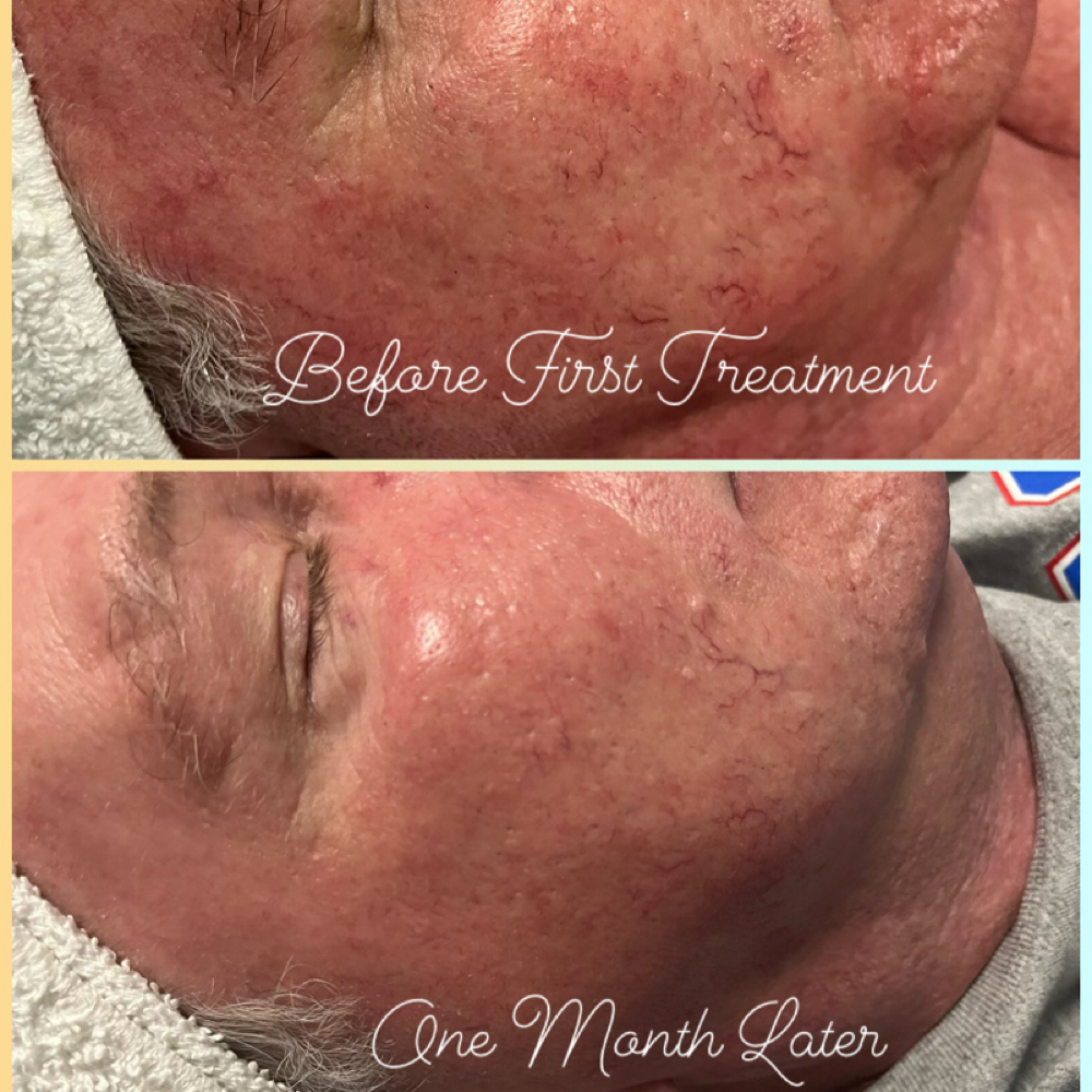 Pro Multivitamin at Natural Beauty Esthetics in Tyler, TX