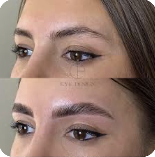 Brow Lamination And Timt