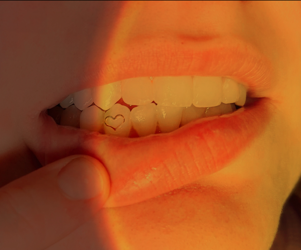 Tooth Gem