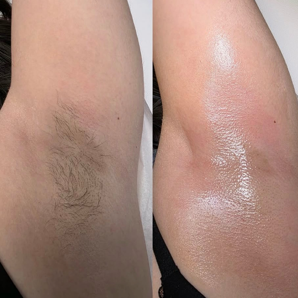 Underarms Wax at Blush Hair & Beauty in harlingen, TX