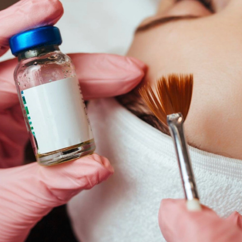 Corrective Chemical Peel at Hy Maintenance Skin in Atlanta, GA