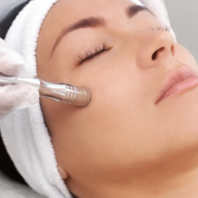 Microdermabrasion Add-On