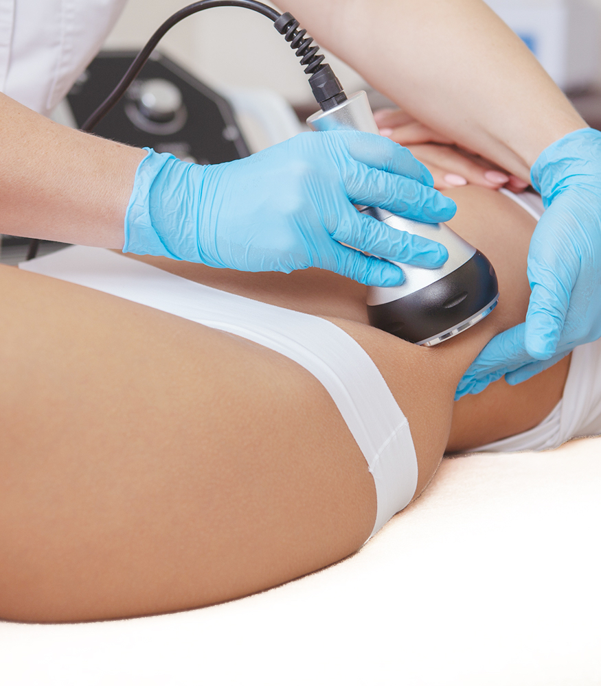 Cavitation