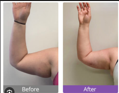Arms
