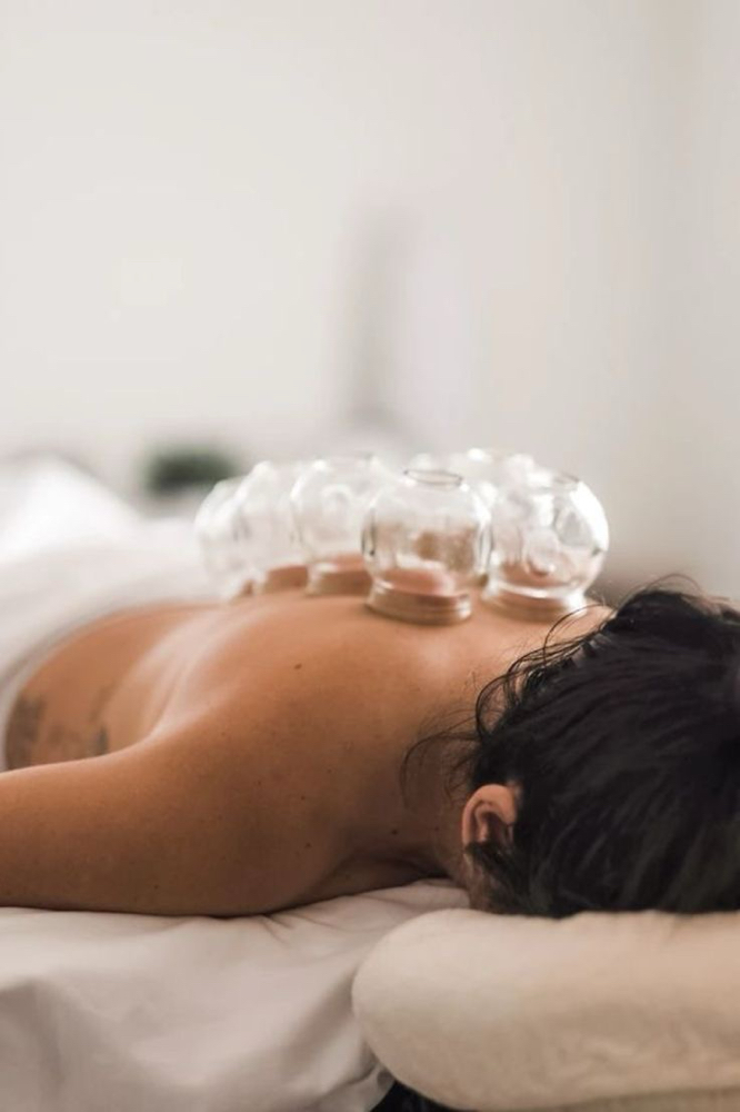 Cupping Therapy