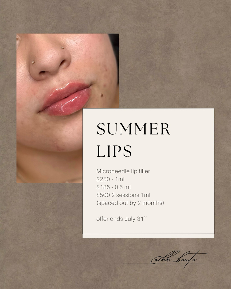 Microneedle Lip Filler