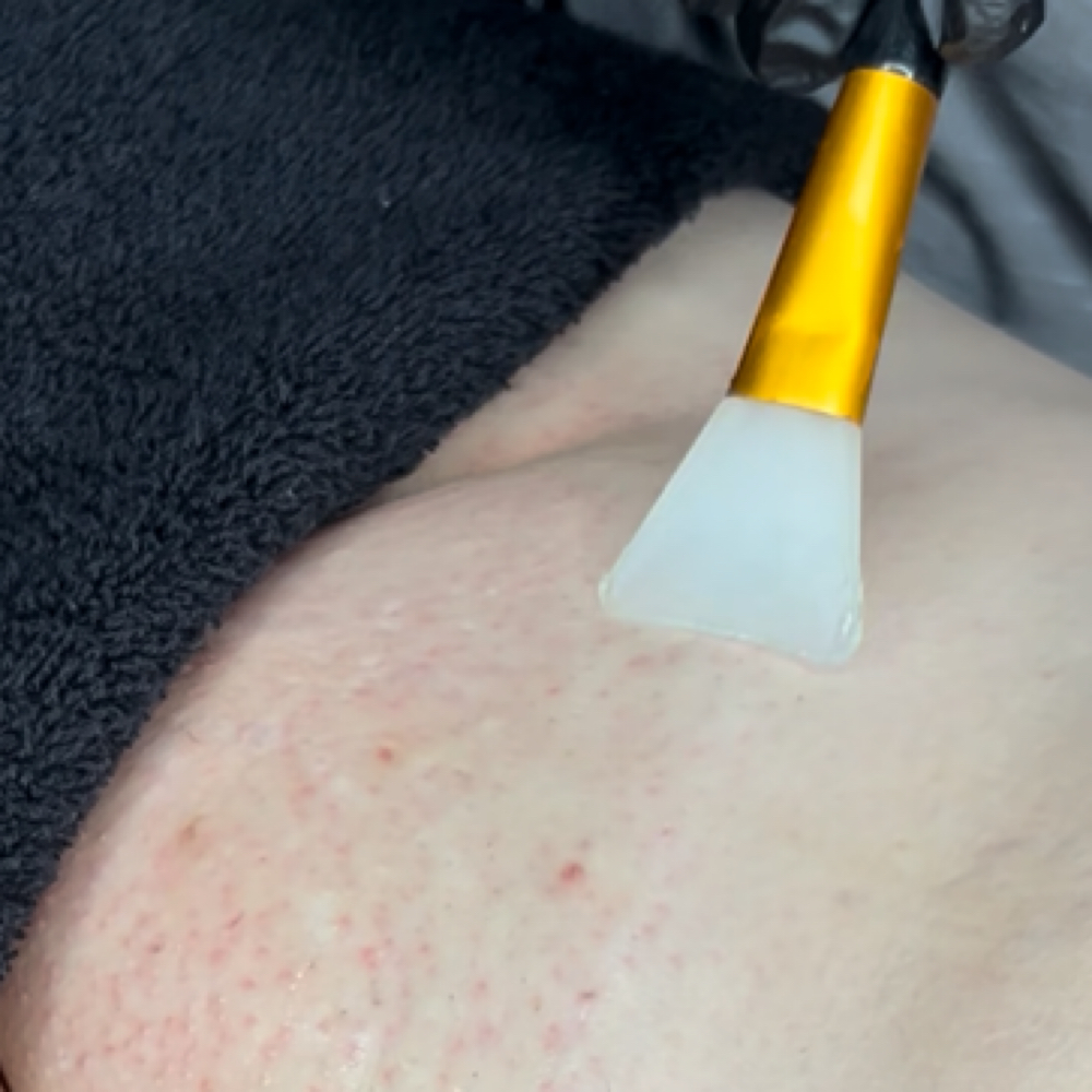 Brightening/Ingrown Treatment at Satin & Sage Waxing LLC in Baton Rouge, LA
