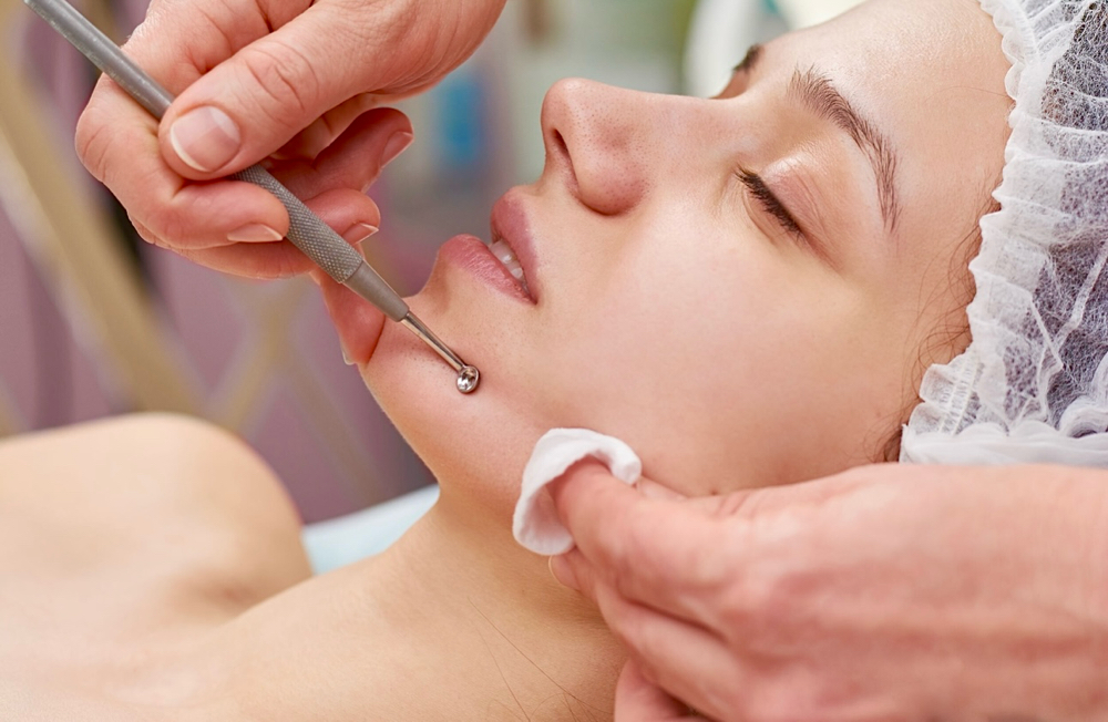 Clarifying (Acne) Facial (Express)