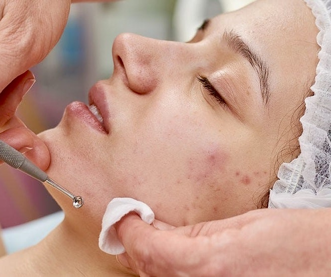 Clarifying (Acne) Facial (Express)