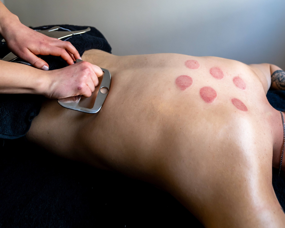 IASTM Massage