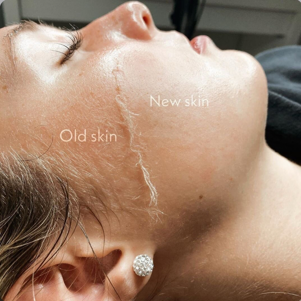 Dermaplane Facial at ENV Beauty Bar in Ontario, CA
