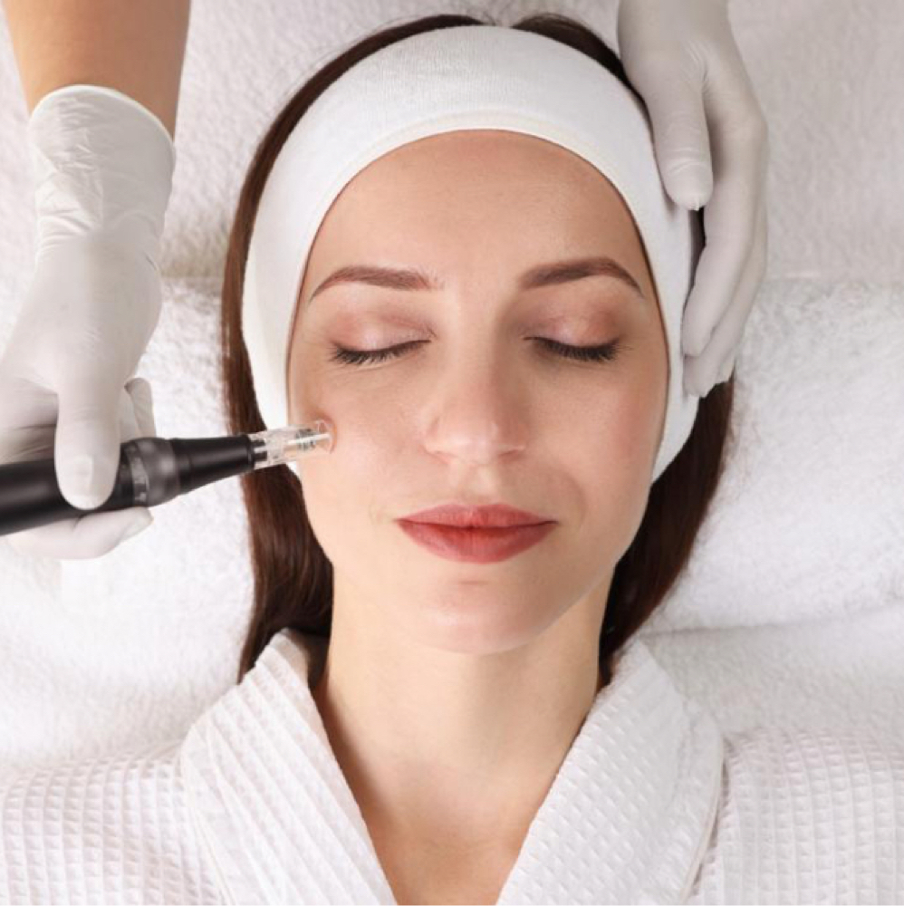 Microneedling at Dinah Manalo, NP - Aesthetic Medicine in Yakima, WA