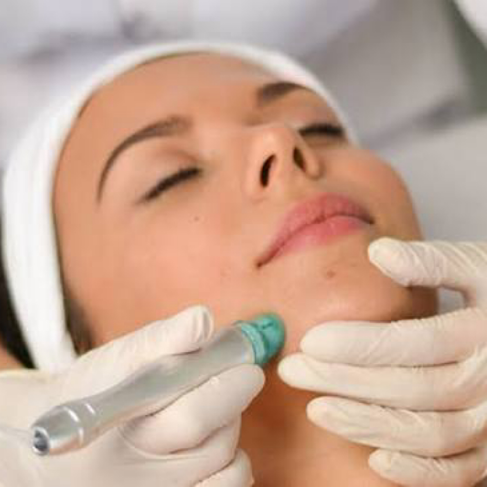 Signature Hydro Dermabrasion at Heavenly Skin Care in Franklin, NH
