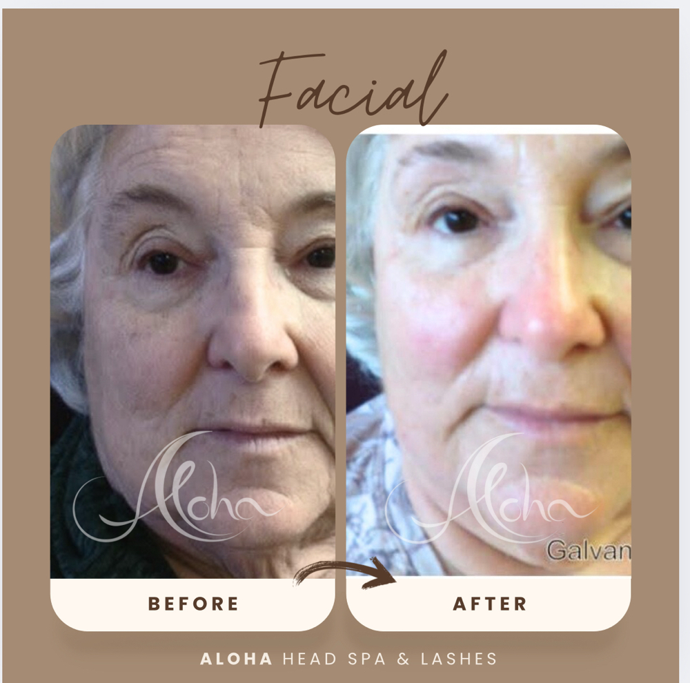 Anti-Aging Facial