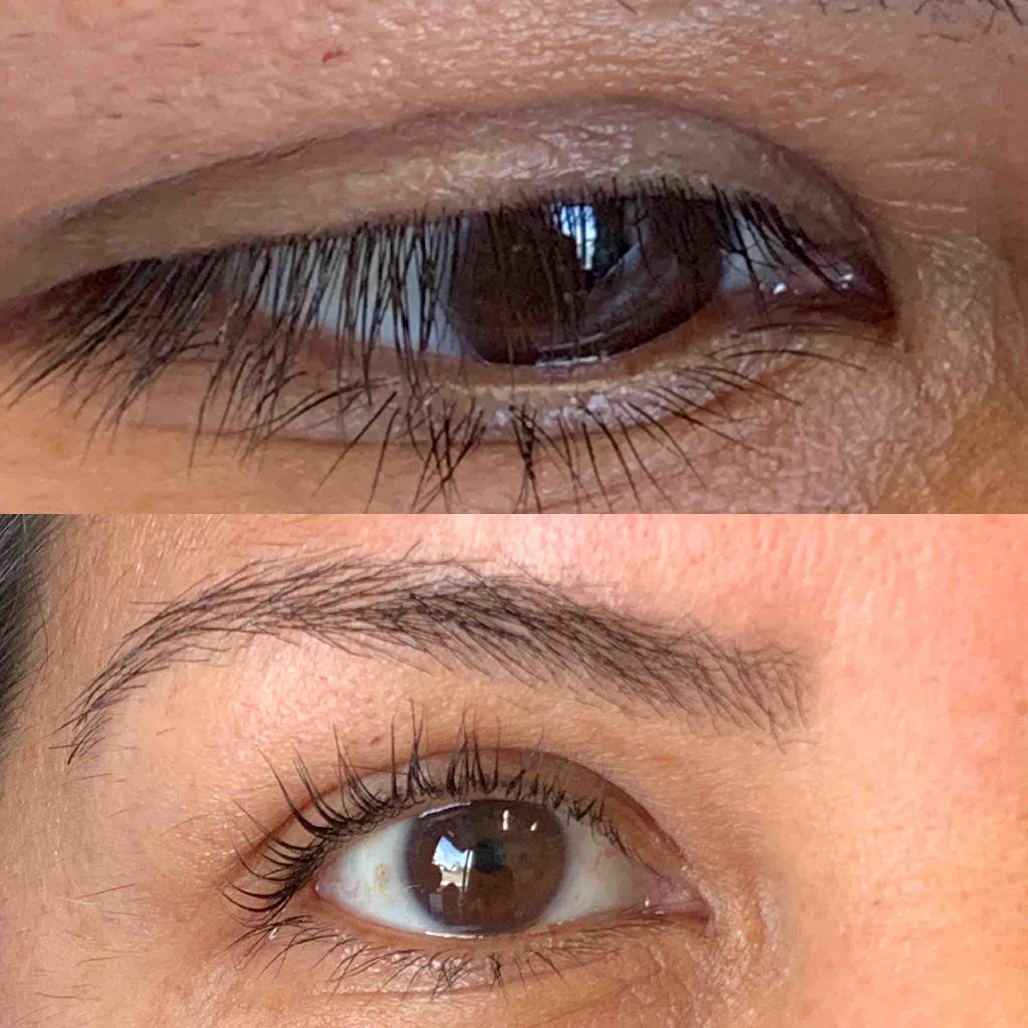 Lashlift