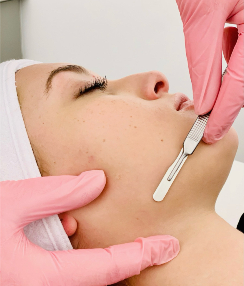 Add Dermaplane To Facial