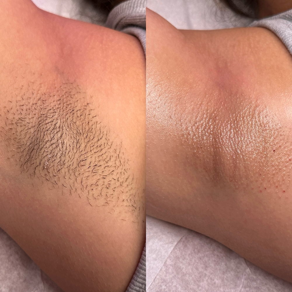 Underarm Wax
