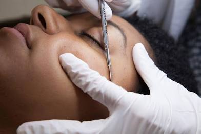 Dermaplaning Facial