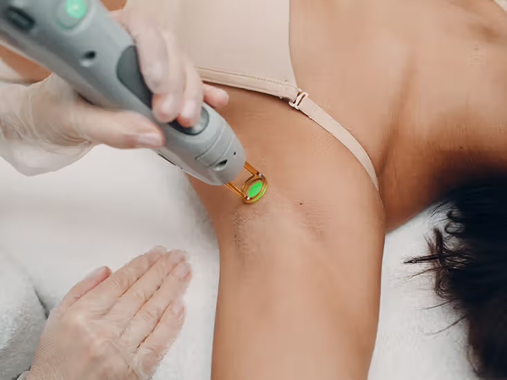 Underarm Hair Removal at Elevate Aesthetics in Trumann, AR