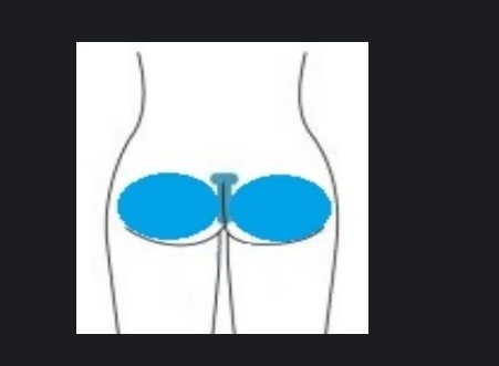 Add On BUTTOCKS
