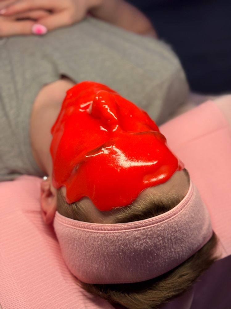 Vampire Facial