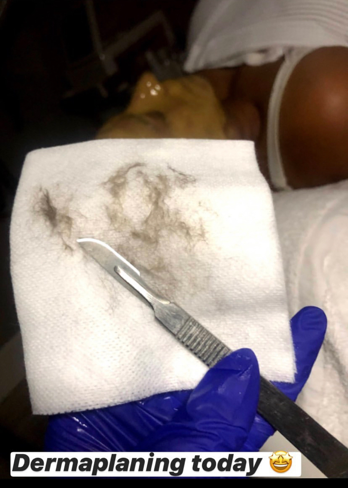Dermaplaning *ADD-ON* Not A Facial