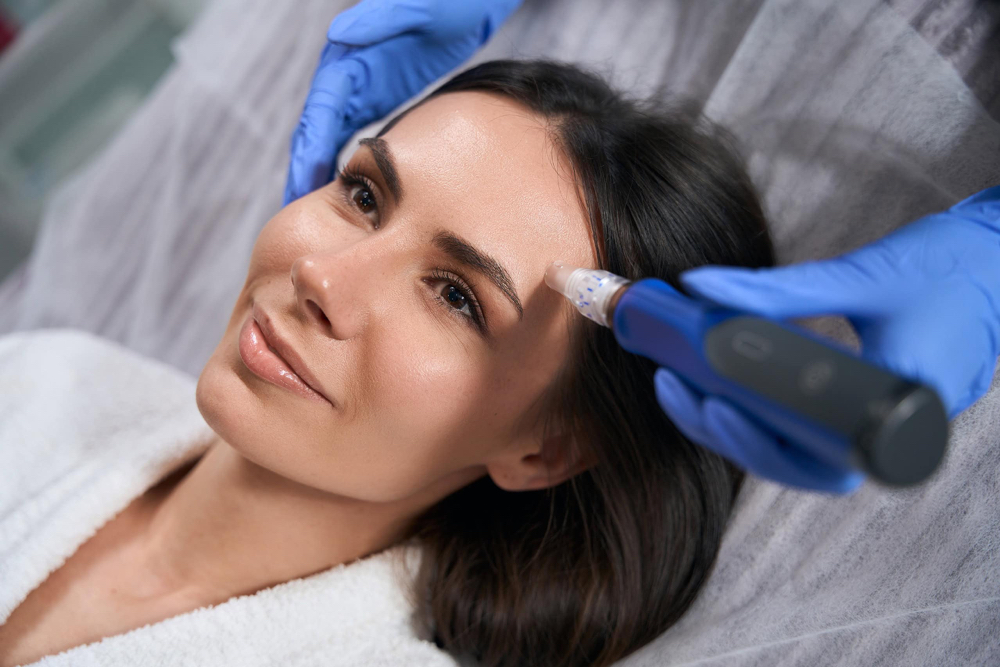 SkinPen Microneedling at Brandy's Beauty Bar SRQ in Sarasota, FL