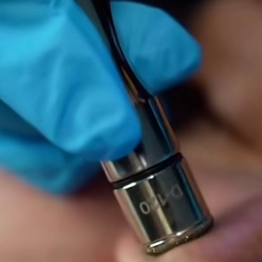 Microdermabrasion Facial at Sanazskincenter in Vienna, VA