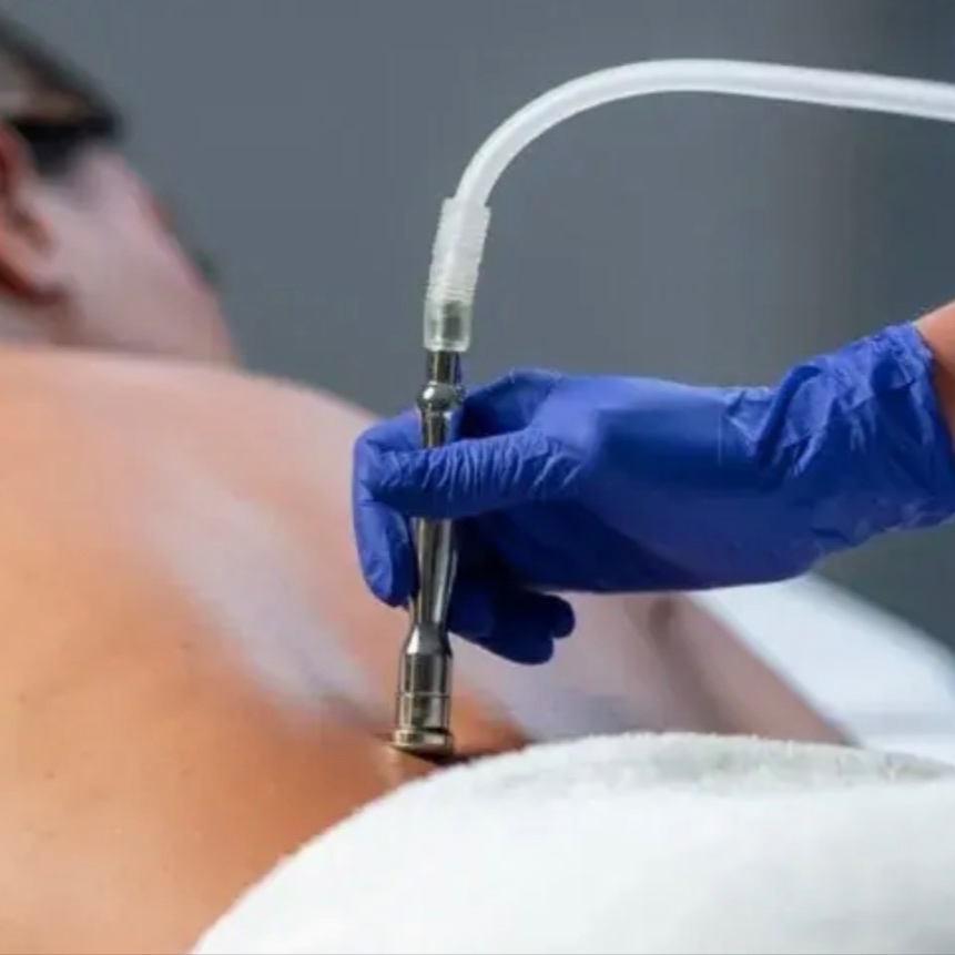 Diamond Microdermabrasion at AETÉRA Spa in Commack, NY