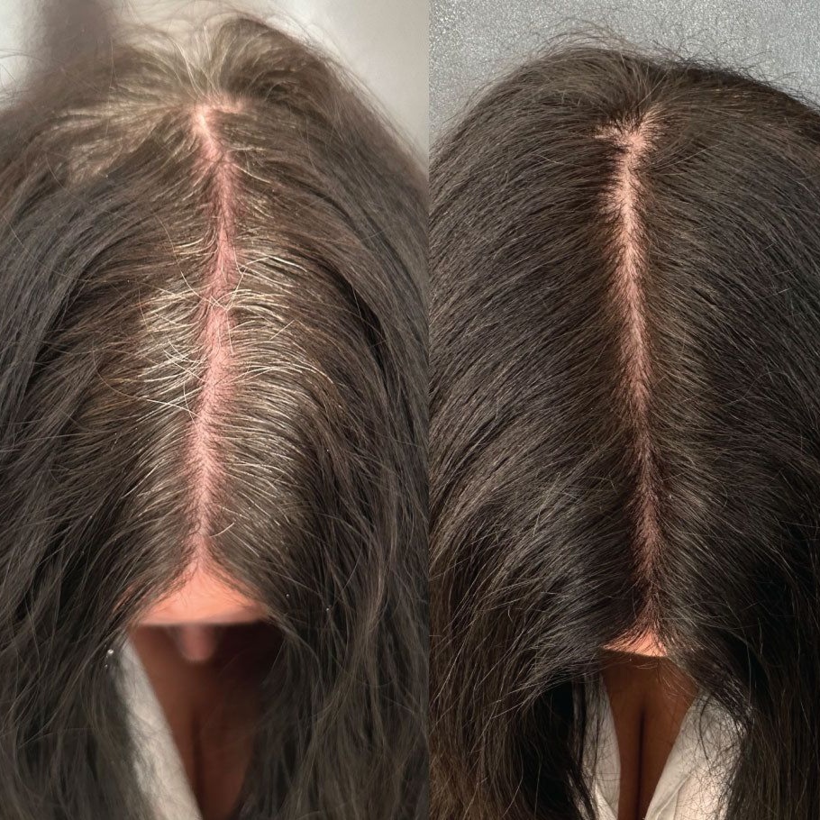 Root Touch Up at Miracle Hair Salon in rockingham, NC