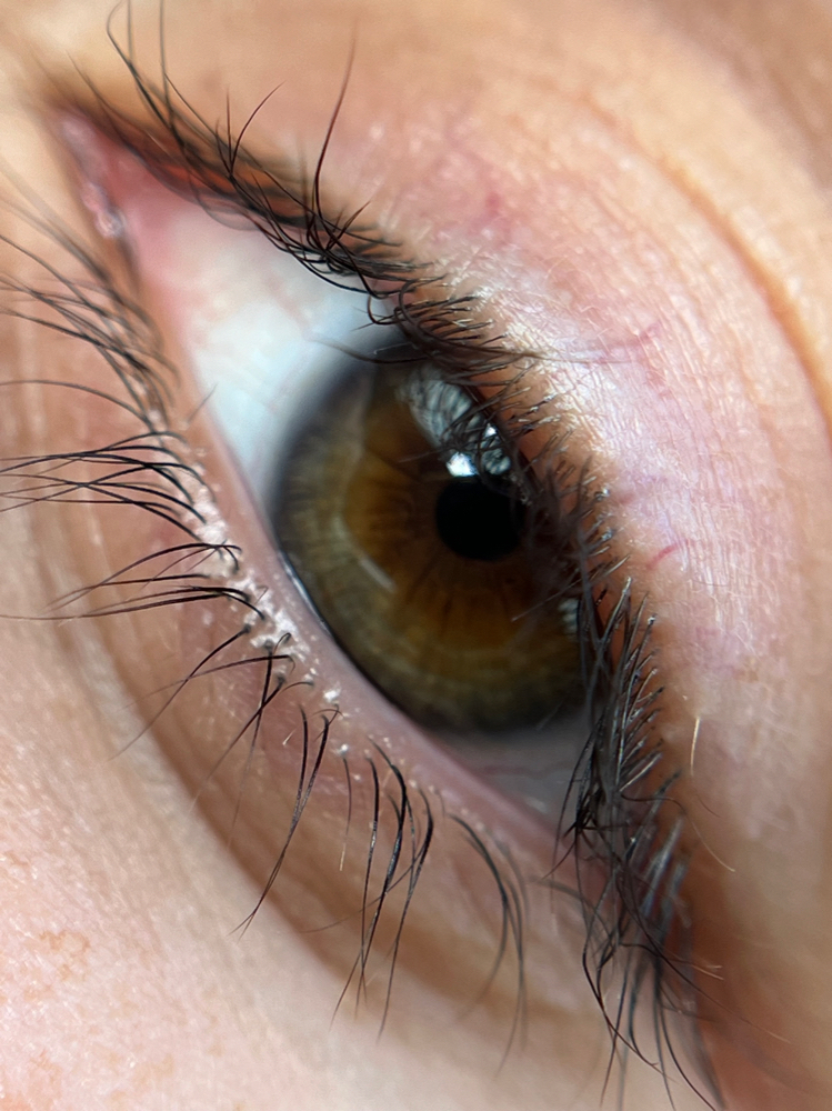 Lash Removal
