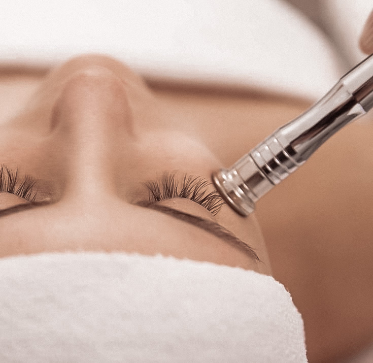 Diamond Tip Microdermabrasion
