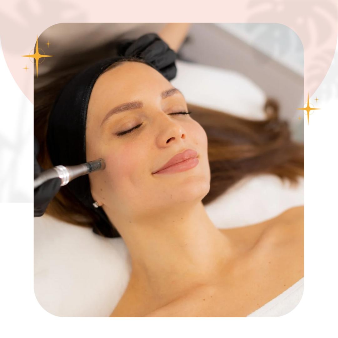 Microneedling at Glam & Glow MedSpa in Plano, TX
