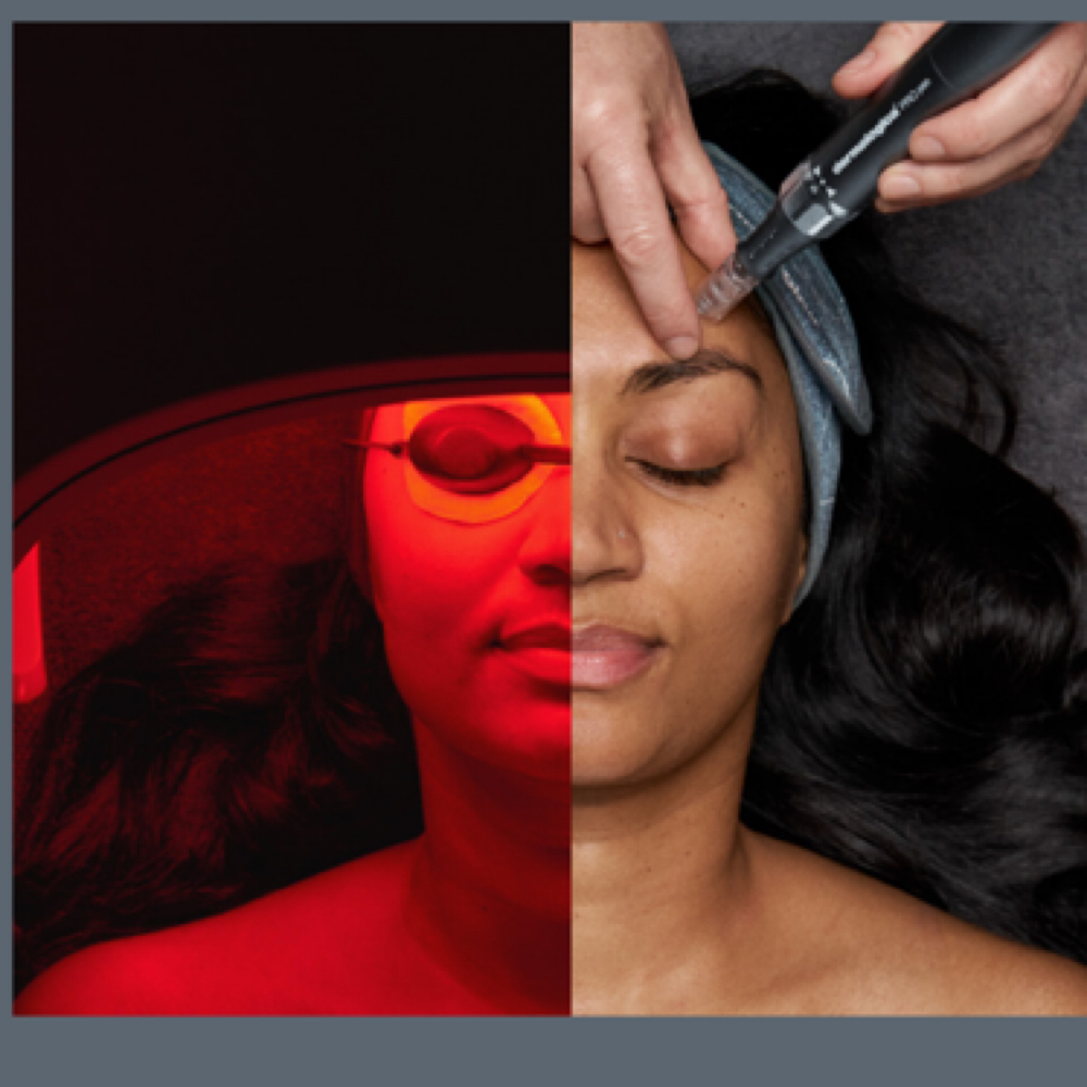 LuminFusion at Jay Lash LLC in buffalo, NY