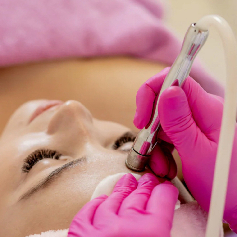 Microdermabrasion Facial at Majestik Skincare in Mobile, AL