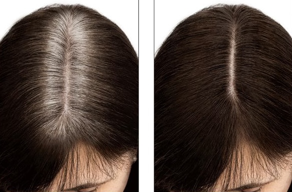 T-zone Color Touch Up/ Trim