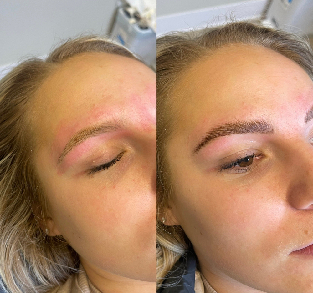 Brow Lamination