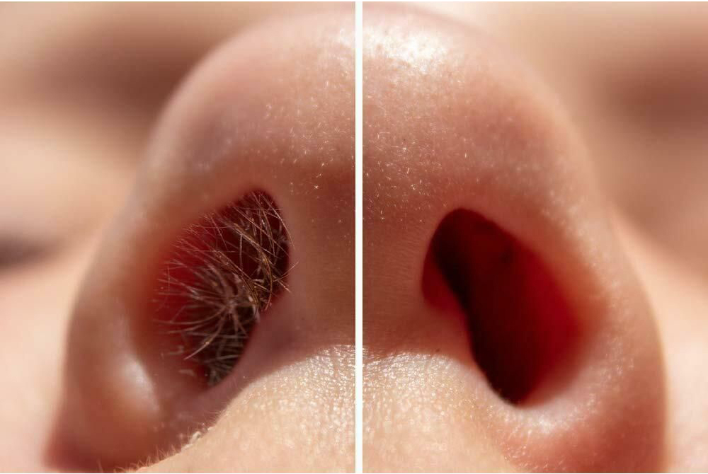 Nose Wax