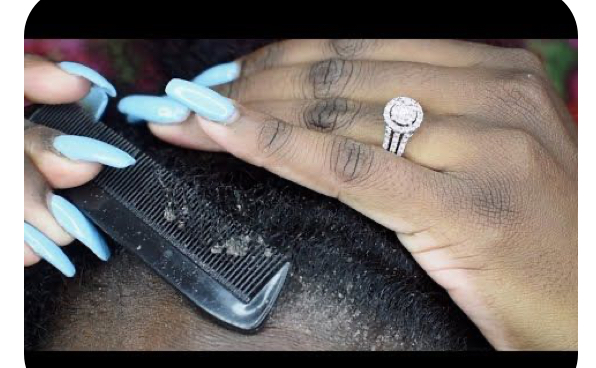 Scalp Detox Treatment