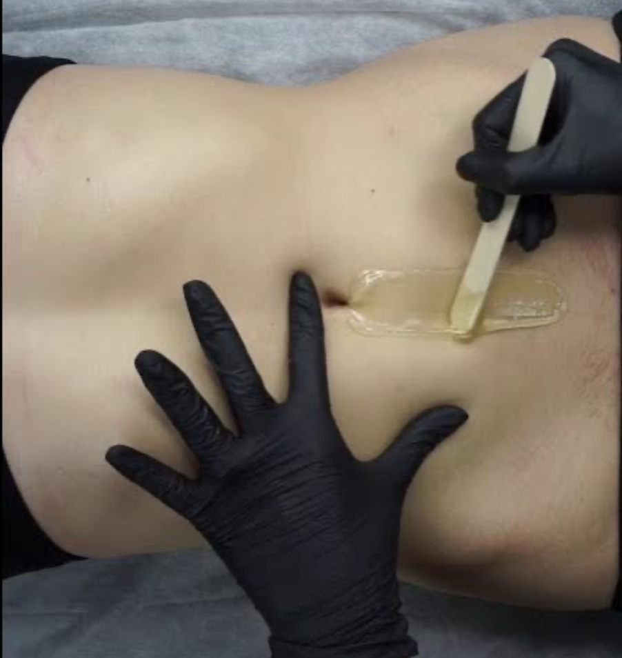 Stomach Strip Wax