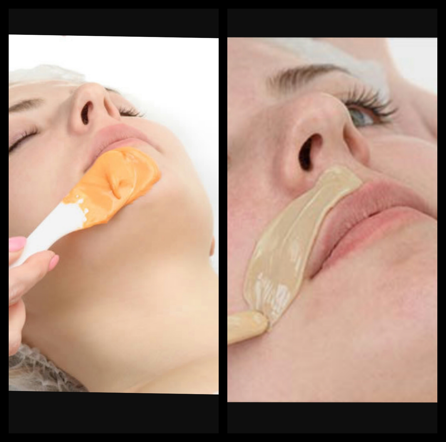 Chin wax